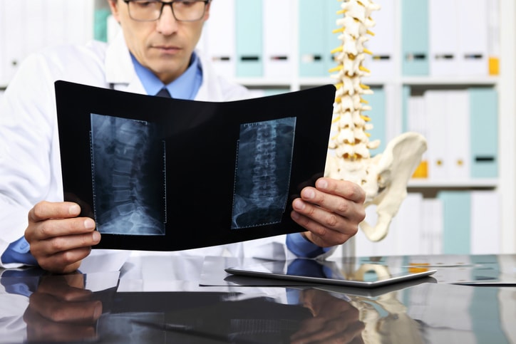 Common Questions about Spinal Cord Injuries