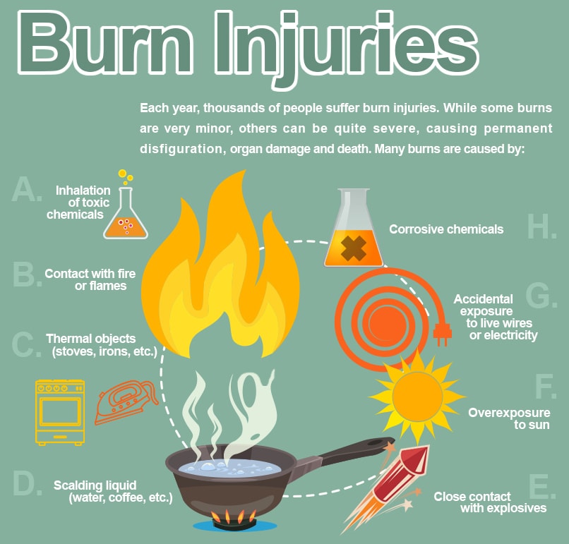 Burn Injury Infographic - Omaha Burn Injury Lawyers
