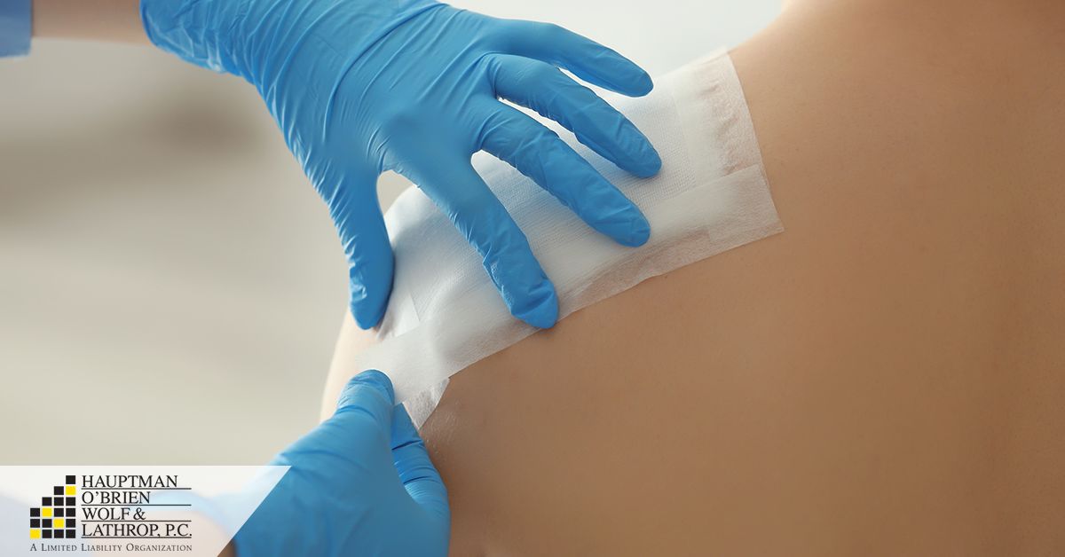 Soft Tissue Wrist Injury Compensation Hermosa Beach thumbnail