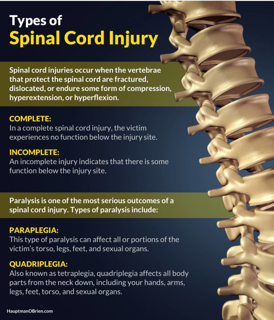 omaha spinal cord injury lawyers 