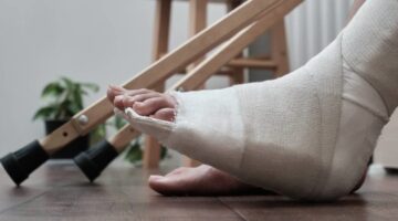 man with a broken foot after a personal injury