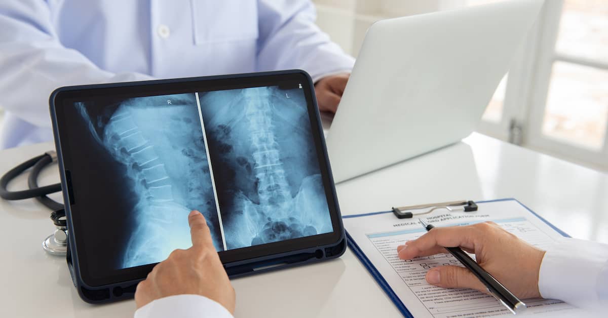 doctor pointing out spinal cord injury complication on medical imaging scan