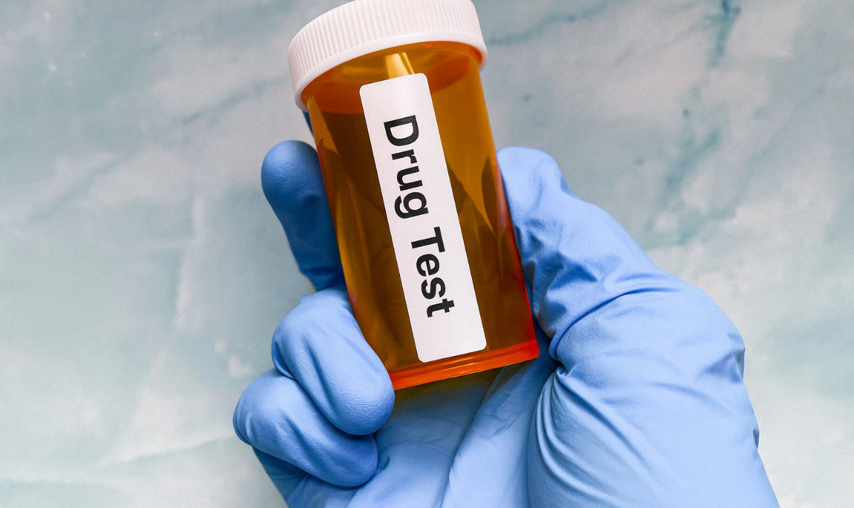 Urine container for drug test held in hand.